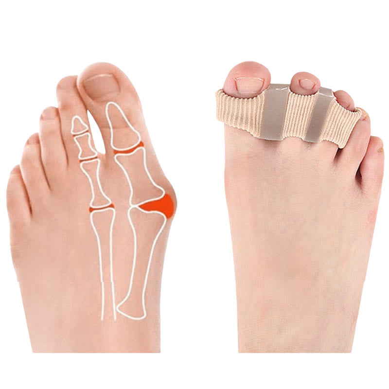 Plusock Multi Hole Toe Alignment Support(2 Packs) - image 3